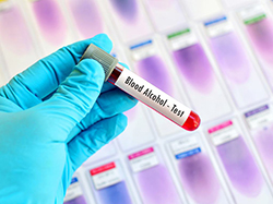 泰州上户口亲子鉴定多少钱一次，泰州权威迁户亲子鉴定机构去哪